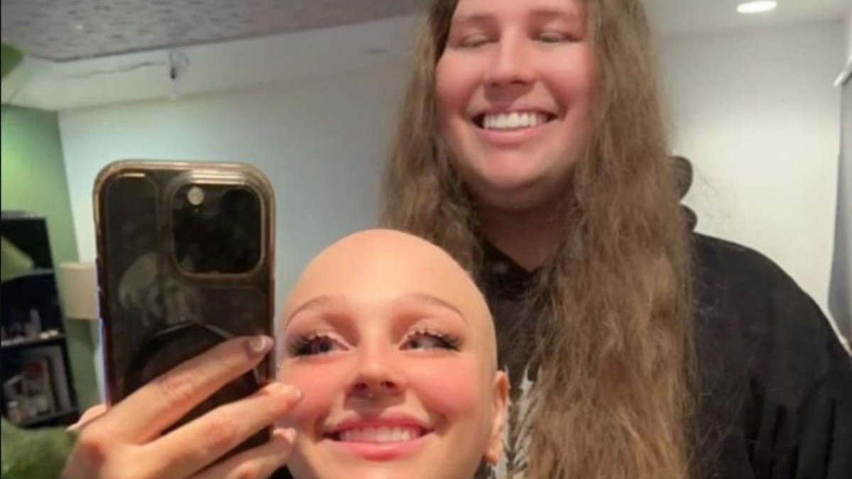 El noble gesto de un hombre con su novia que padece alopecia: Se dejó crecer el cabello para donárselo