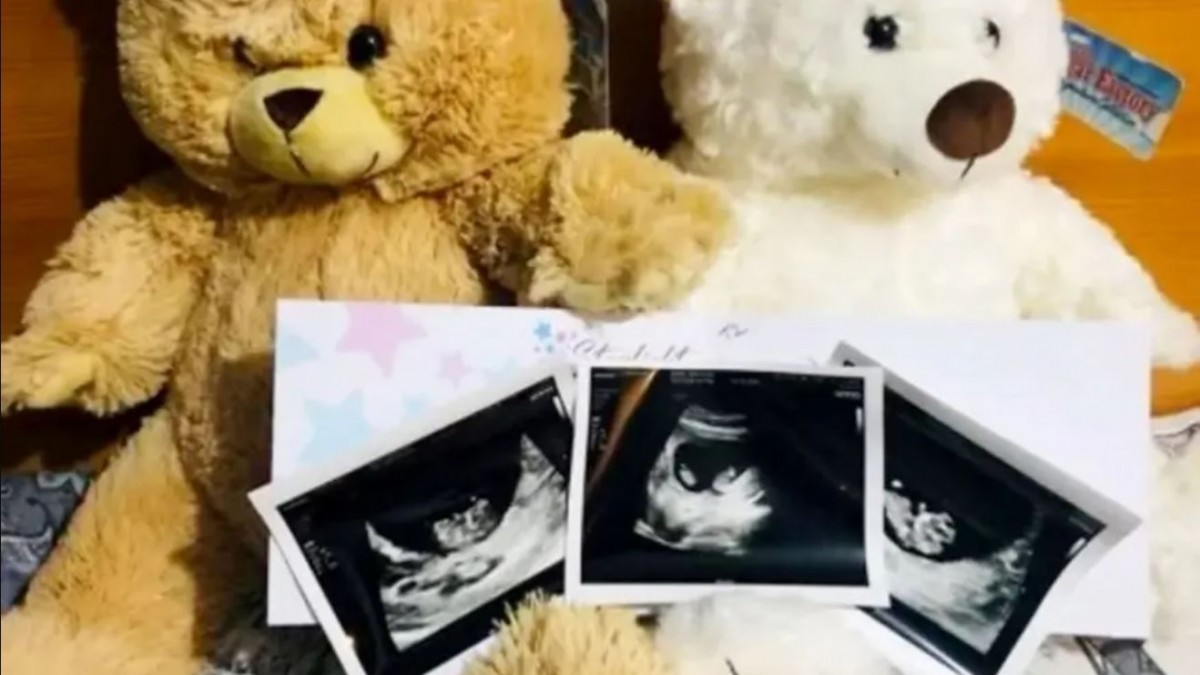 «No podía creerlo»: Mujer dio a luz a gemelos con 22 días de diferencia