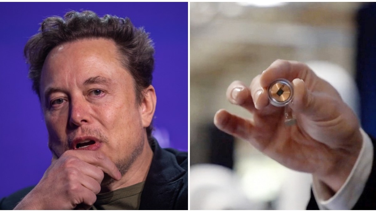 Malas noticias para Elon Musk: Falló el primer implante de chip cerebral realizado por su empresa Neuralink