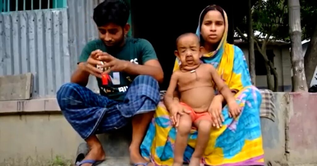 Bayezid Hossain, la vida extraordinaria de un niño en el cuerpo de un anciano