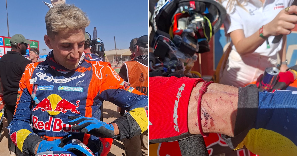 Heridas, calambres y desgaste mental: la dureza extrema de la etapa 1 del Rally Dakar