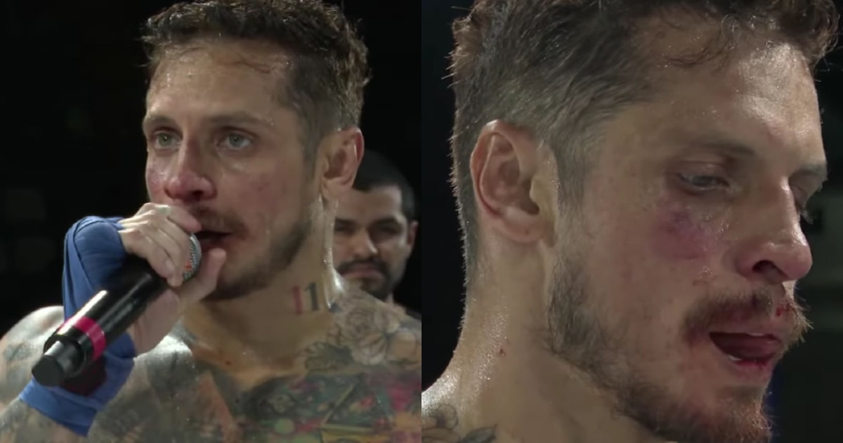 Nico Ponce y cómo terminó su rostro luego de pelear contra Jenko del Río en el Celebrity Combat
