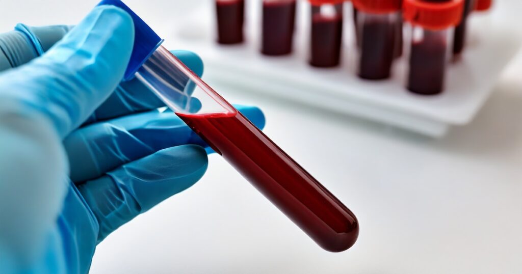 ¿Se curó la infección de Chagas? Un nuevo test podría dar la respuesta