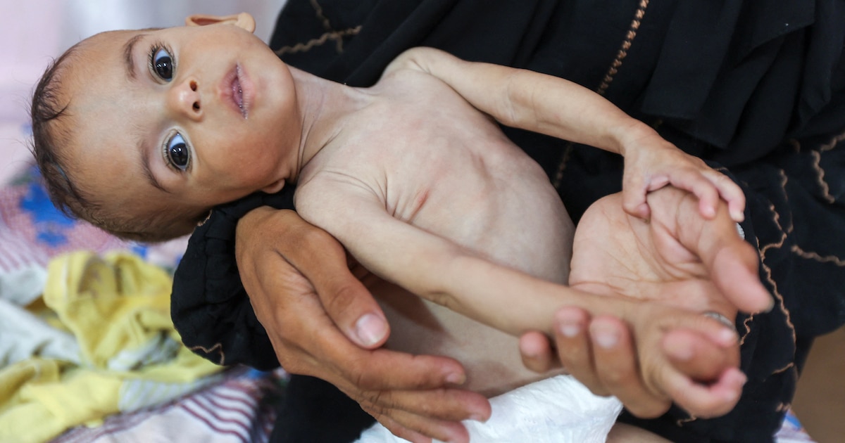 Hospitals en Gaza sin alimentos: enfermeras colapsan, bebés en riesgo