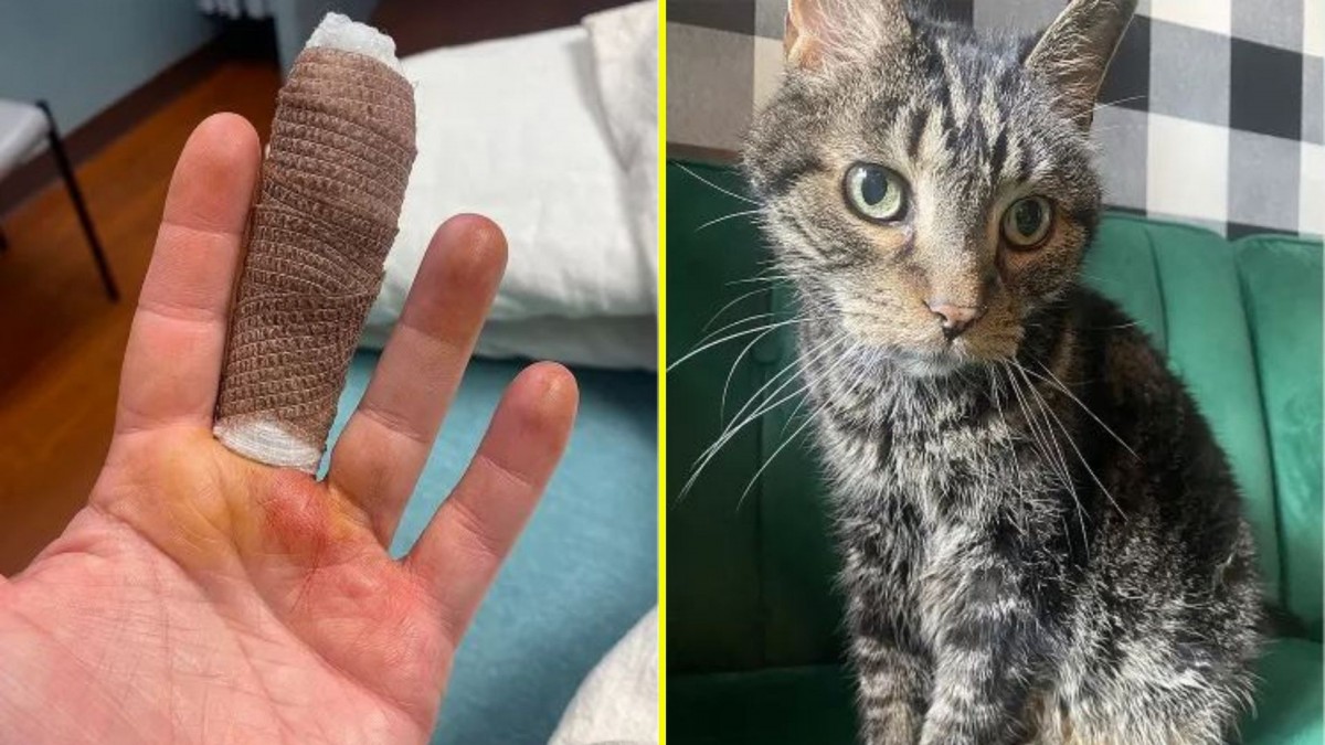 Gato provoca grave infección en dedo y le deben extirpar la uña