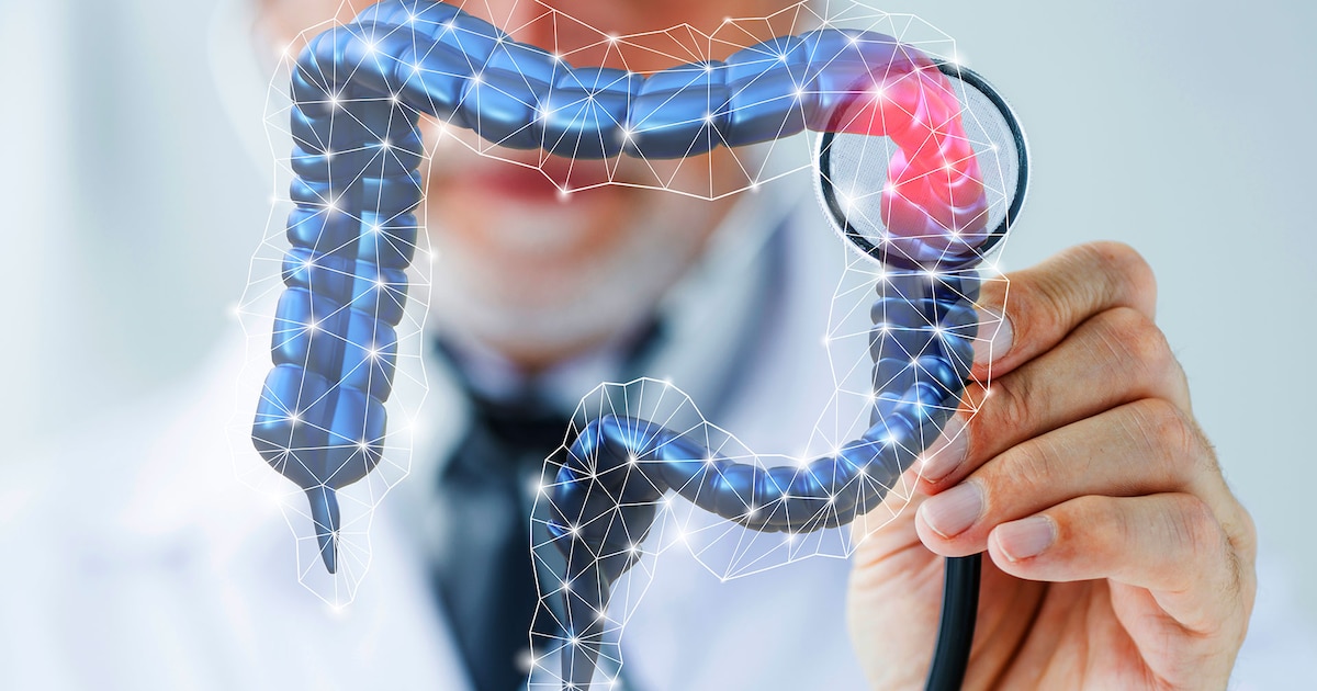 Guía de la colonoscopia: procedimiento, indicaciones y prevención del cáncer colorrectal