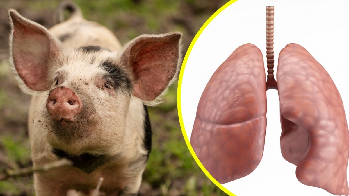 ¡Impactante avance en medicina: Científicos chinos realizan el primer trasplante de pulmón de cerdo a humano y logran que funcione durante Nueve Días!