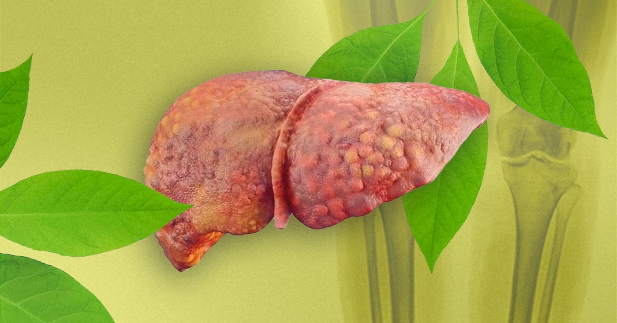 UNAM destaca planta medicinal para aliviar dolores óseos, inflamación hepática y problemas renales