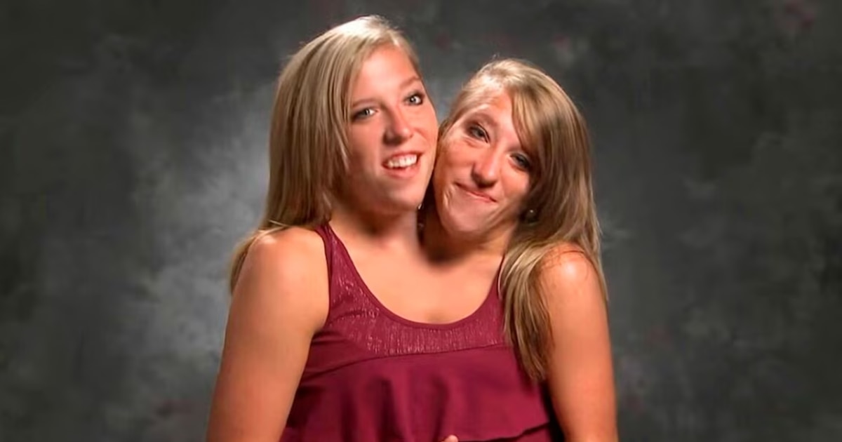 ¡Increíble! Las gemelas Abby y Brittany Hensel, iconos de la historia médica, aparecen con un recién nacido tras décadas de misterio y especulaciones sobre su maternidad