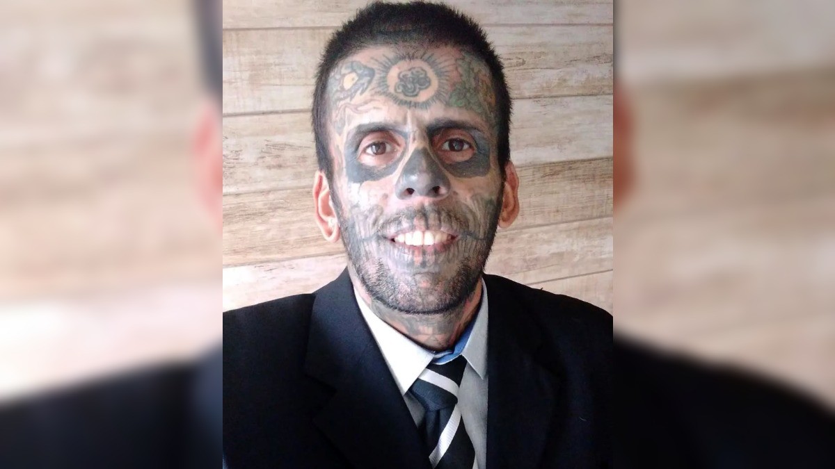 ¡Del Hombre Más Tatuado de Brasil a Nuevo Hombre! Leandro de Souza revela su impactante transformación tras someterse a múltiples cirugías para borrar el 95% de sus tatuajes y volver a empezar