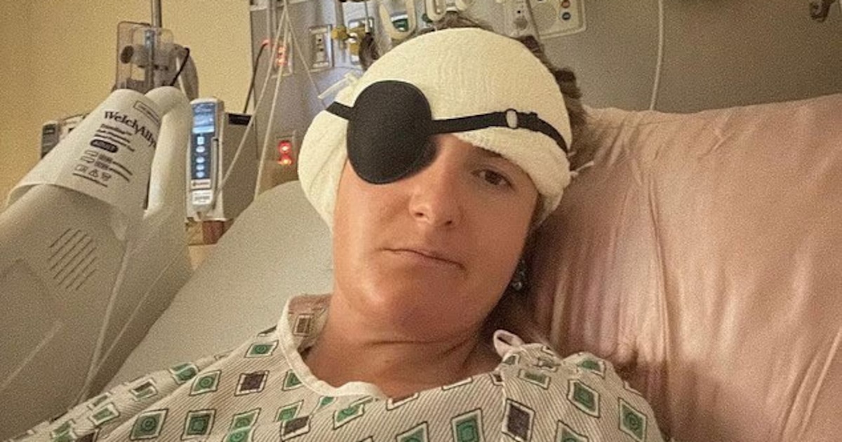 ¡Sorpresa mortal! Mujer de 28 años descubre que décadas de síntomas inexplicables ocultaban un tumor cerebral que pudo haberle costado la vida