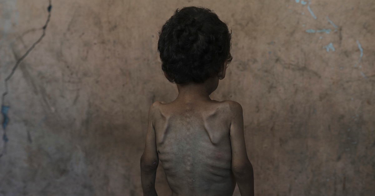 Crisis humanitaria en Gaza: Médicos del Mundo denuncia bloqueo que impide atender a enfermos y desnutridos