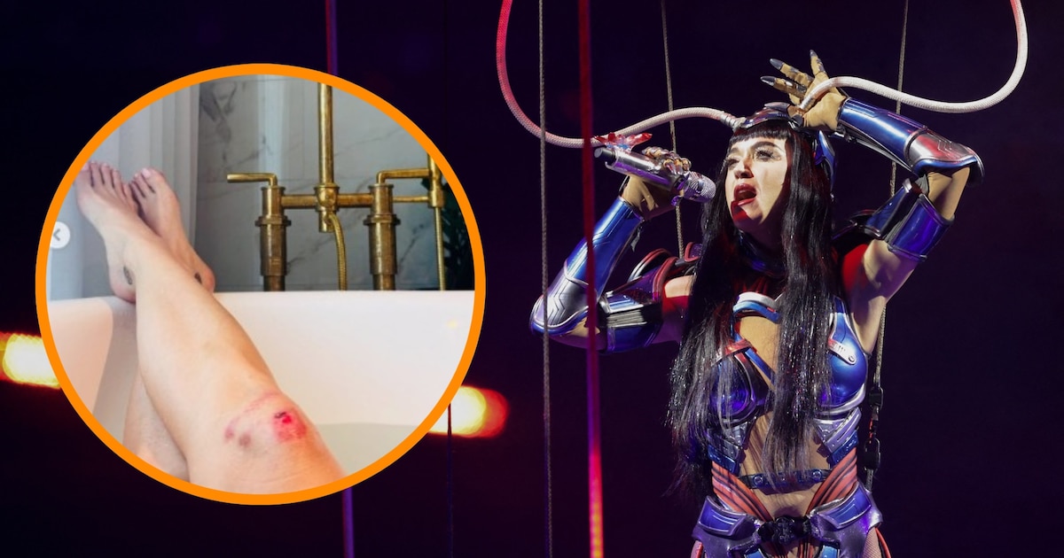 Katy Perry revela lesiones tras accidente en escenario durante su gira Lifetimes Tour