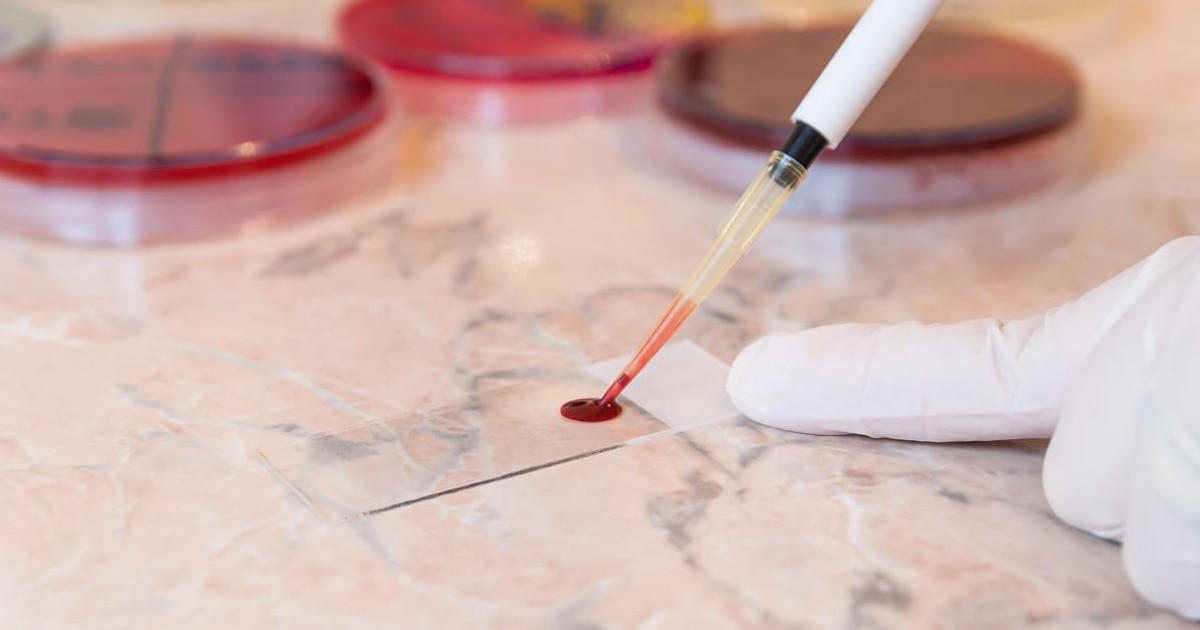 Innovador dispositivo NasRED de la Universidad Estatal de Arizona detecta enfermedades infecciosas y crónicas en 15 minutos con una sola gota de sangre y por solo 2 dólares