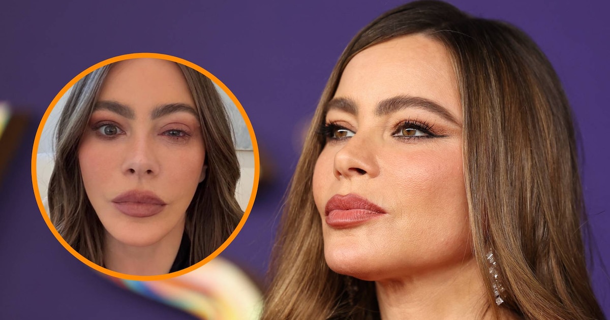 Sofía Vergara abandona los Emmy por una severa alergia ocular y termina en urgencias