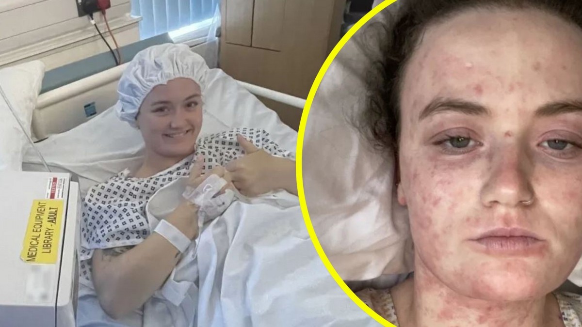 Joven casi muere por error médico: Diagnóstico equivocado y sepsis mortal en Inglaterra