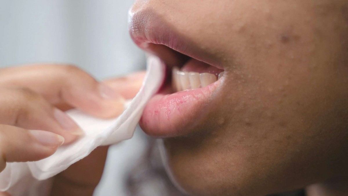 ¡Alerta en EE.UU.: Retiran 15,000 paquetes de toallitas Neutrogena por bacteria mortal!