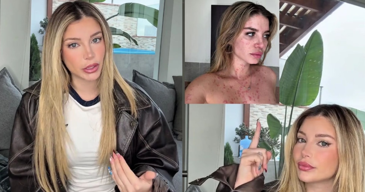 Flavia Laos revela lucha contra enfermedad incurable: “Mi cuerpo habló por mí”