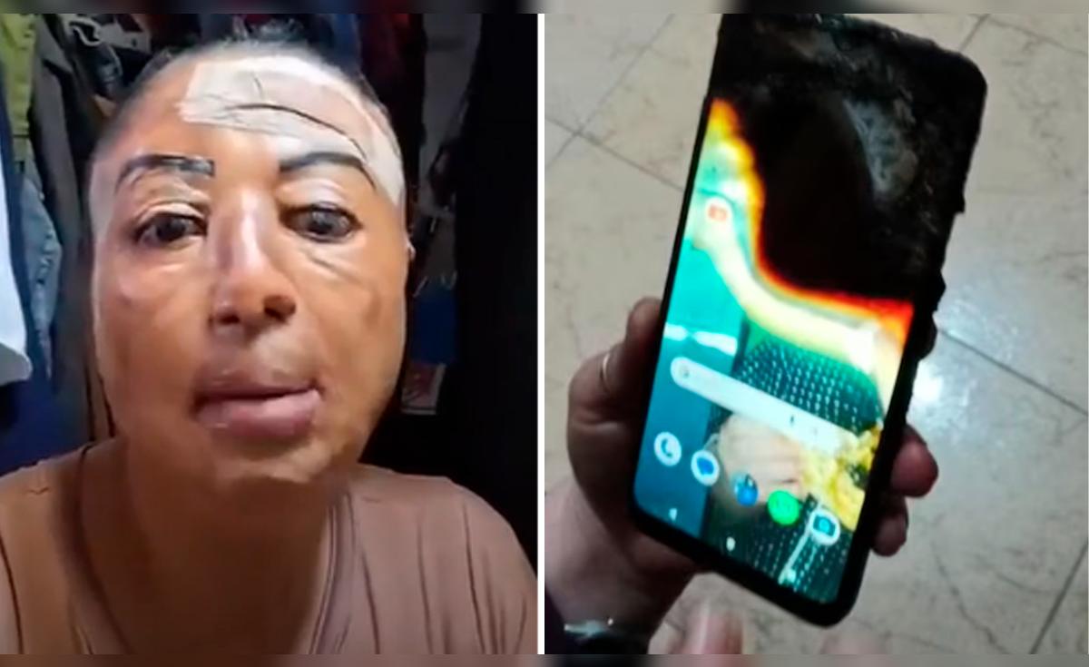 Joven colombiana casi muere al explotar su celular mientras dormía: advertencia mortal sobre sobrecalentamiento y riesgos de cargar junto a