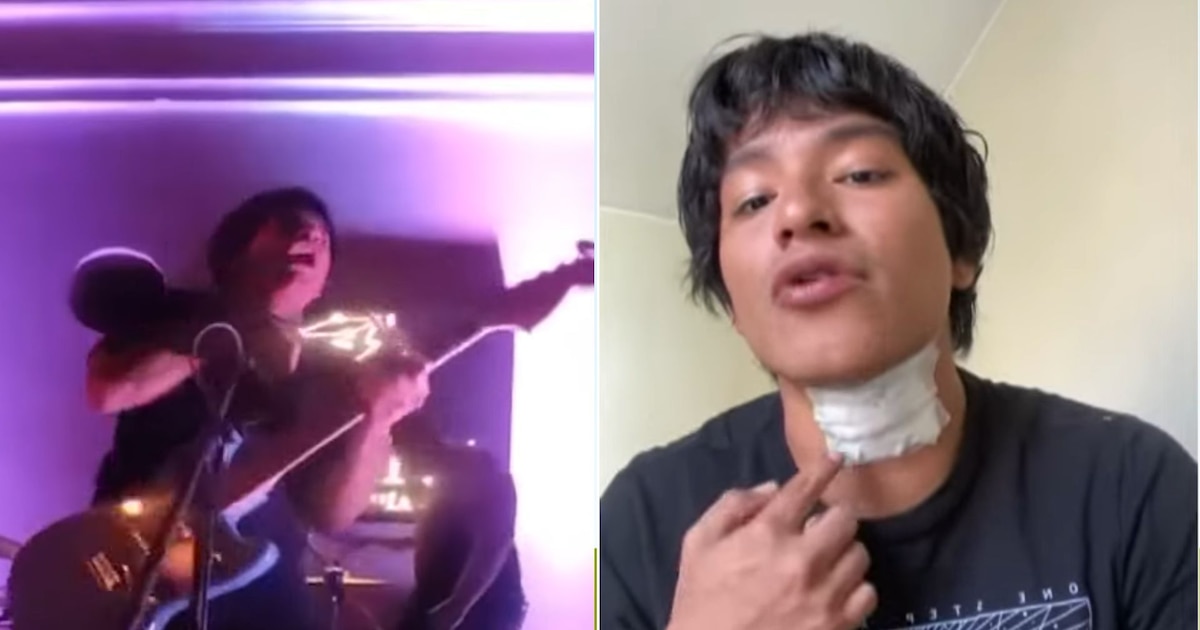 Cantante relata cómo sobrevivió a una descarga eléctrica durante concierto en Lima
