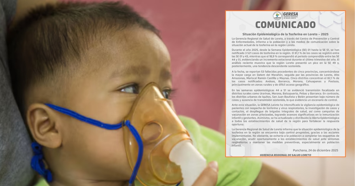 Geresa Loreto confirma 53 muertes infantiles por tos ferina por retrasos en vacunación