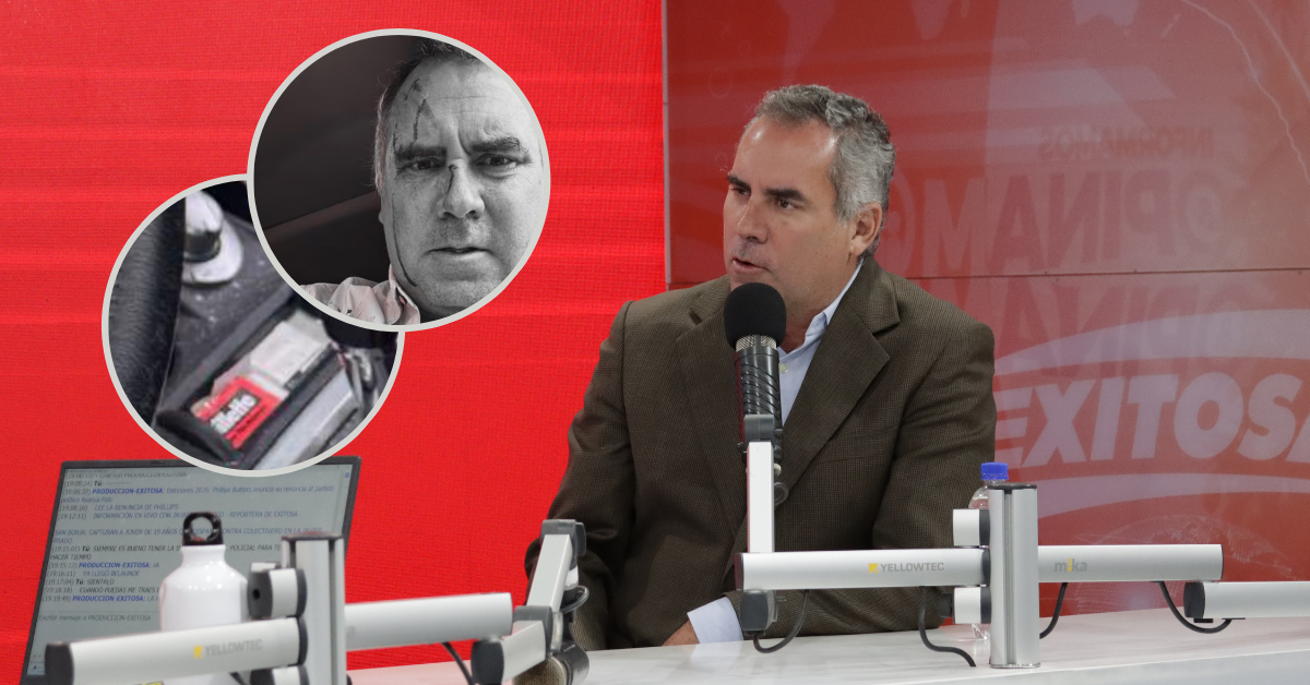 Rafael Belaunde Llosa niega autolesiones con Gillette y aclara que tiene rasguños